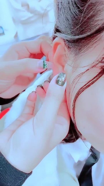 最新打耳洞视频教程，轻松掌握打耳洞技巧
